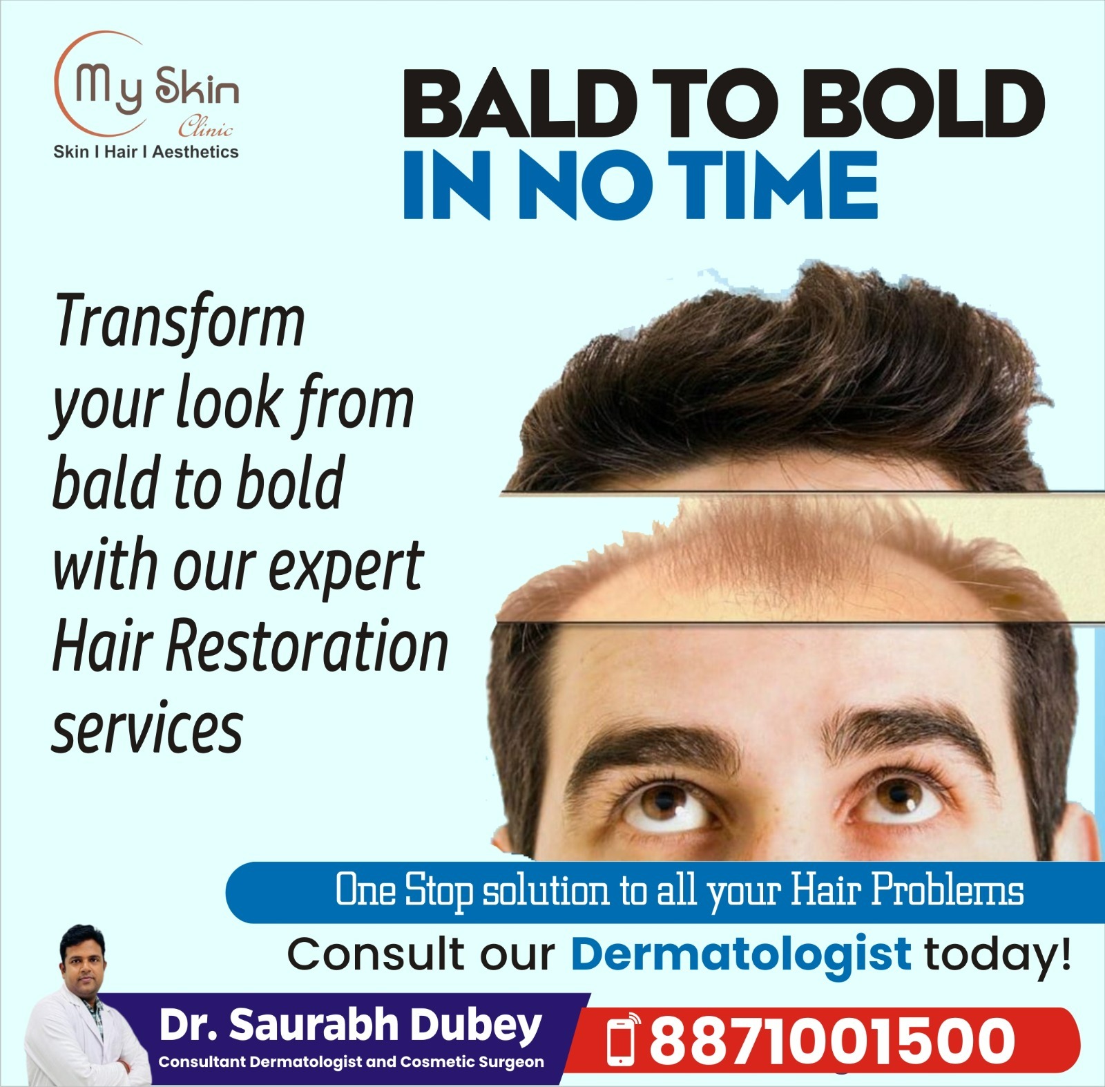 Best Hair Treatment Doctor In Indore